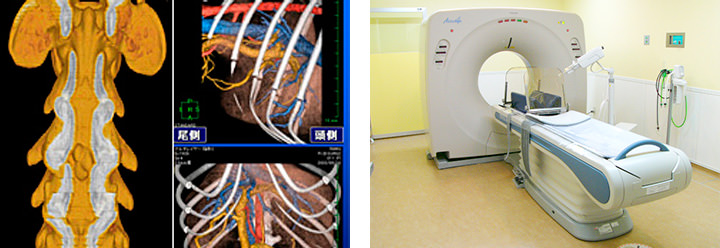 画像診断 CT検査