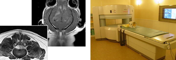 MRI（Magnetic Resonance Imaging：磁気共鳴画像）